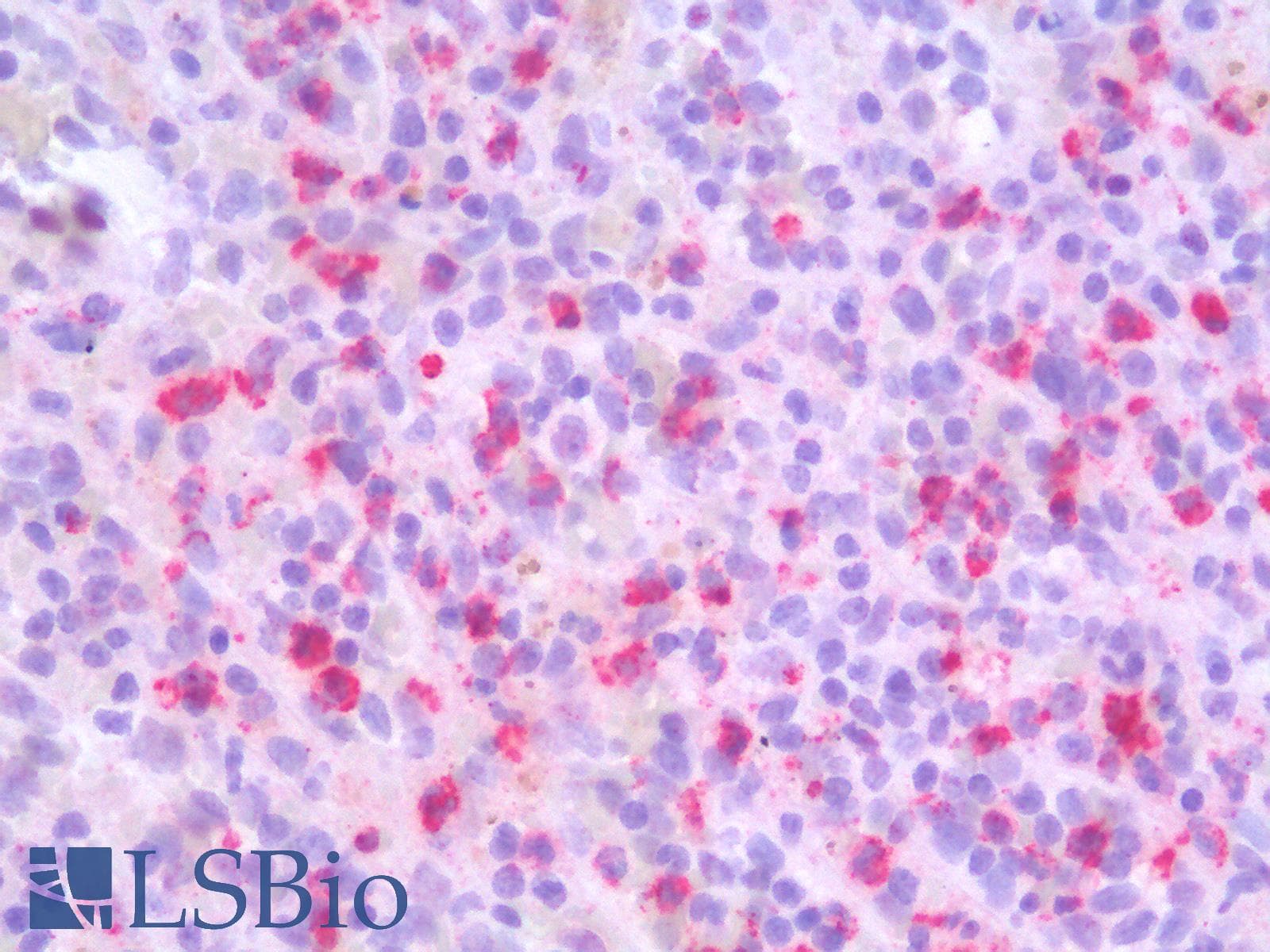 PathPlus™ Polyclonal Rabbit anti-Rat MMP9 / Gelatinase B Antibody (IHC)