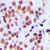 Polyclonal Rabbit anti-Human HNRNPL / hnRNP L Antibody (Internal, IHC, IF, WB)