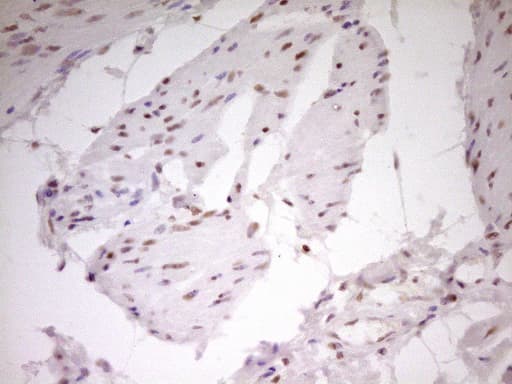 NR2C2 / TAK1 Antibody (aa1-241, clone OTI1F3)