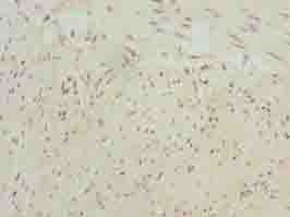 NBPF3 Antibody