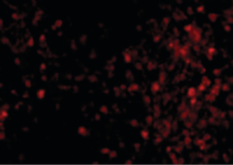 IHC-plus™ TRPC6 Antibody