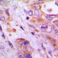 Polyclonal Rabbit anti-Human RPLP2 Antibody (Internal, IHC, WB)