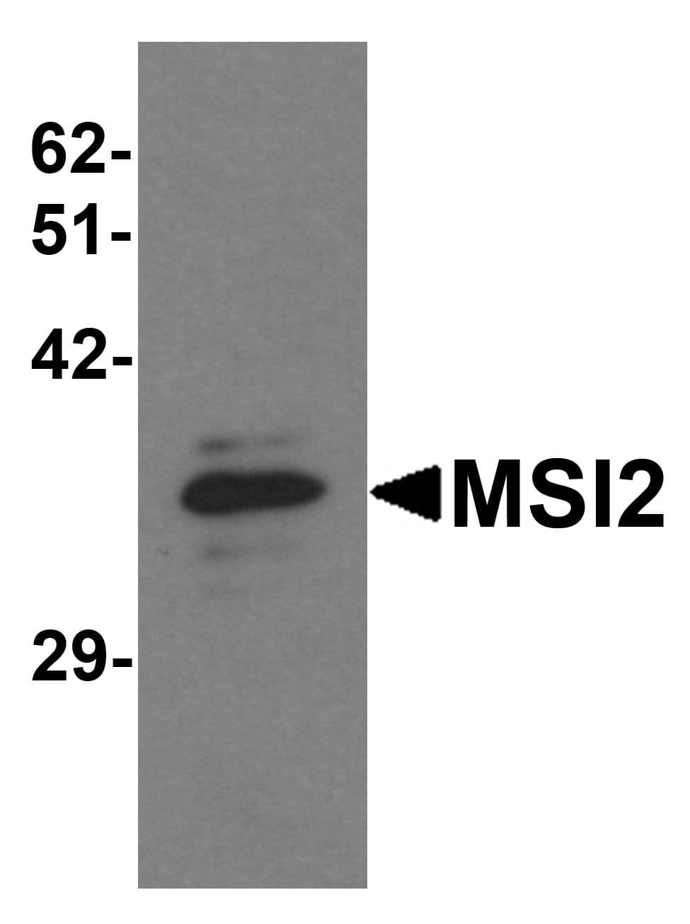 IHC-plus™ MSI2 Antibody