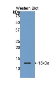 FSH Receptor / FSHR Antibody (aa18-113)