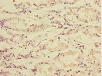 Polyclonal Rabbit anti-Human TXNDC5 / ERP46 Antibody (IHC, WB)