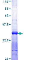 Human S100B / S100 Beta Protein (Recombinant GST)
