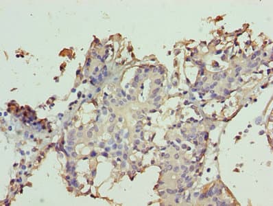 Polyclonal Rabbit anti-Human TTC9C Antibody (IHC, WB)