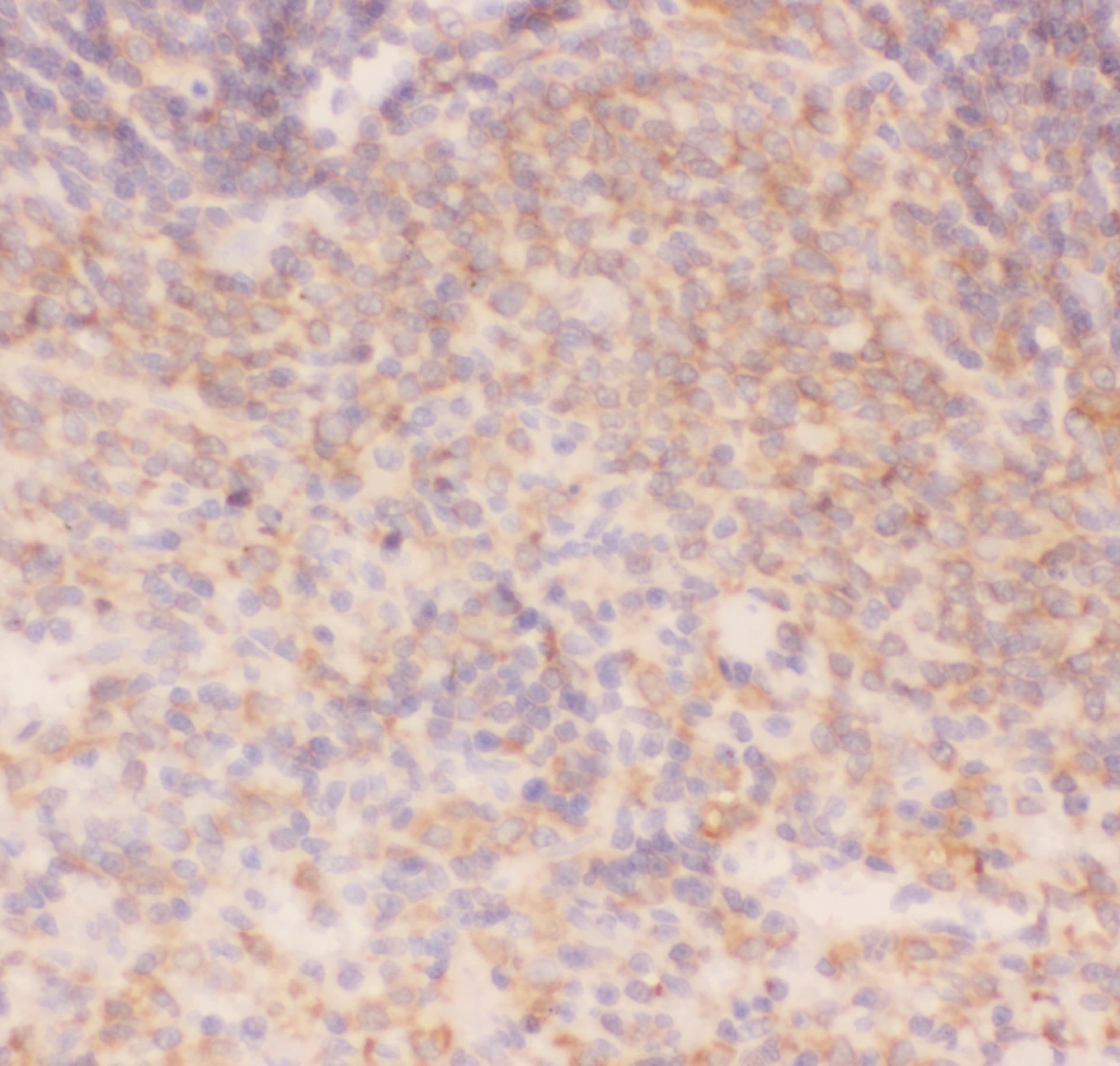 Polyclonal Rabbit anti-Human CHUK / IKKA / IKK Alpha Antibody (aa411-745, IHC, WB)
