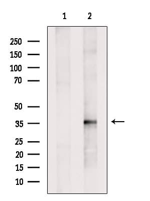 Polyclonal Rabbit anti-Human HIBADH Antibody (IF, WB)