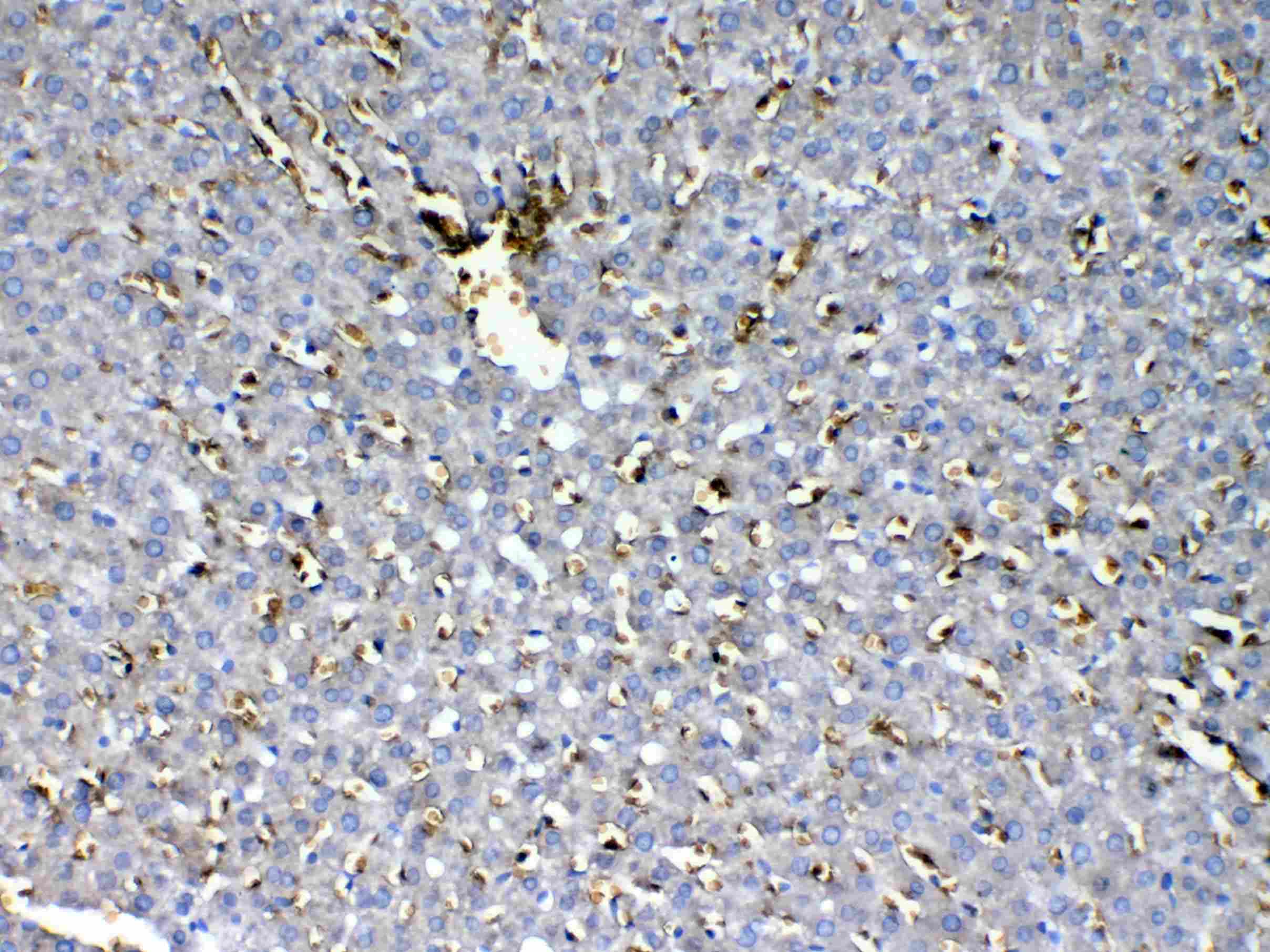 HBD / Hemoglobin Delta Antibody