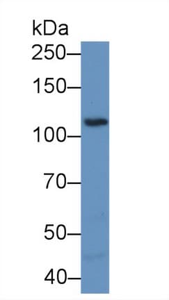 PTK2B / PYK2 Antibody (aa704-941)