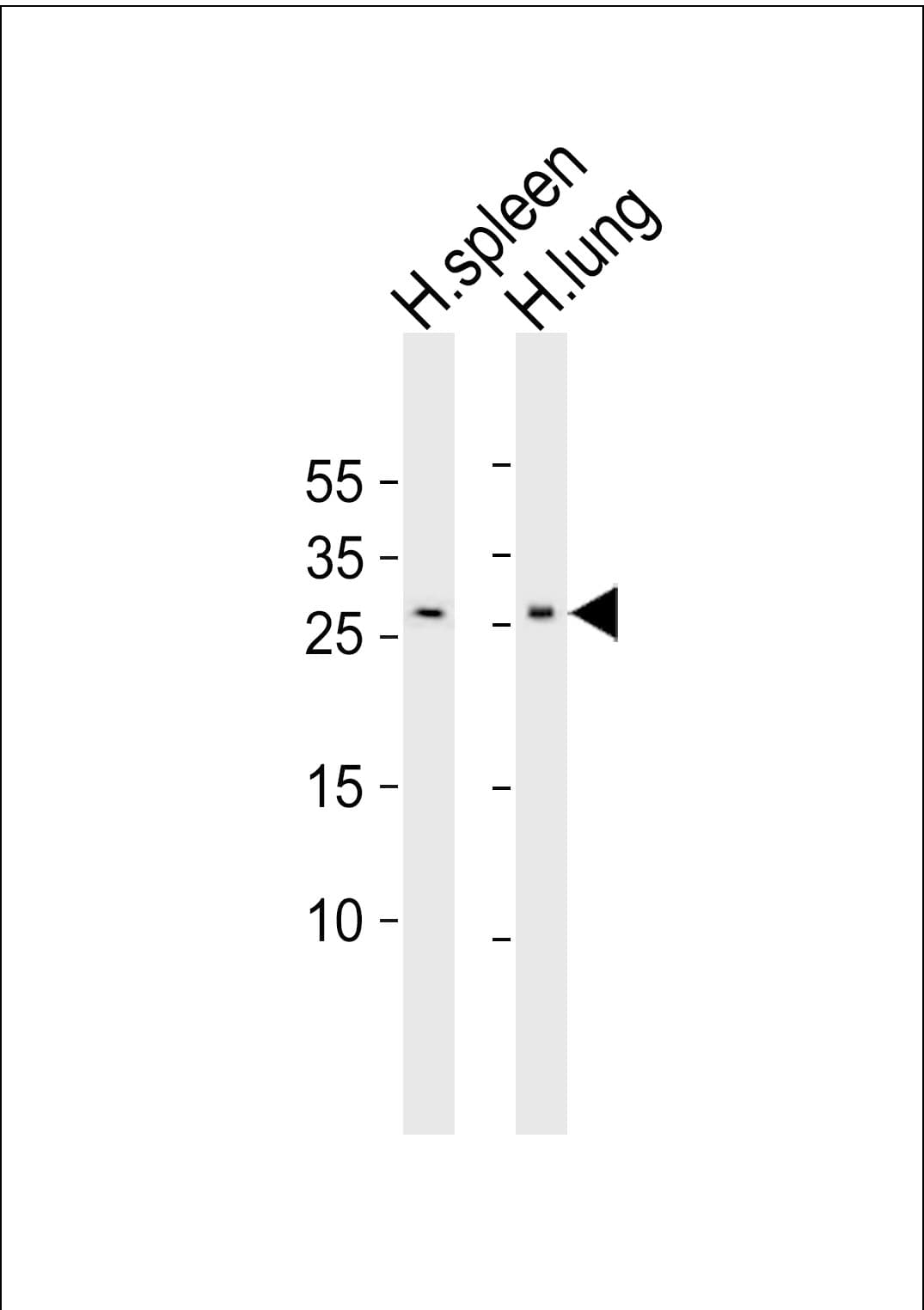 Polyclonal Rabbit anti-Human CXCL16 Antibody (aa150-183, WB)