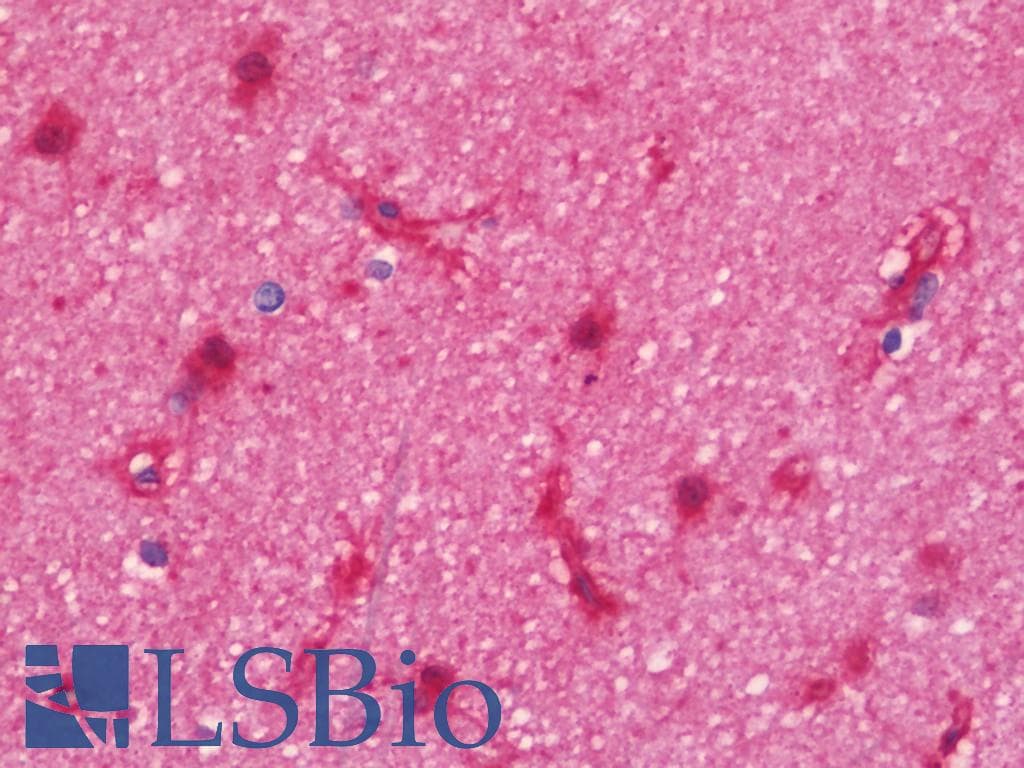 IHC-plus™ SNTA1 / Syntrophin Alpha 1 Antibody (aa191-505)