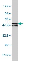 IHC-plus™ KRT81 / Keratin 81 / KRTHB1 Antibody (clone 3B10-5B10)