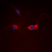 Polyclonal Rabbit anti-Human FOXO1 / FKHR Antibody (Internal, IHC, IF, WB)