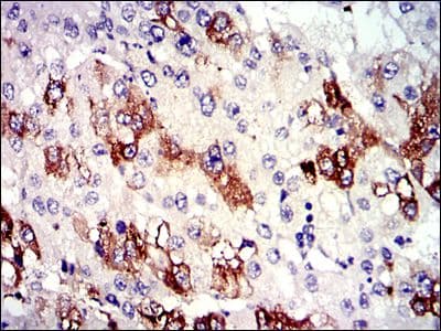 TUBA8 / Tubulin Alpha 8 Antibody (clone 2D6)