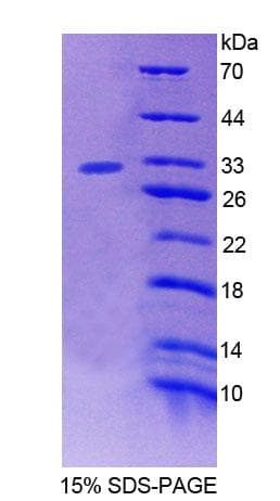 Human PTPN3 Protein (Recombinant His-T7, N-terminus)