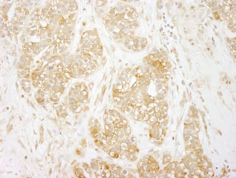 RELA / NFKB p65 Antibody (aa501-551)