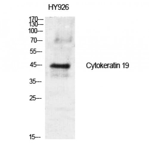 KRT19 / CK19 / Cytokeratin 19 Antibody (200-280 aa, Internal)