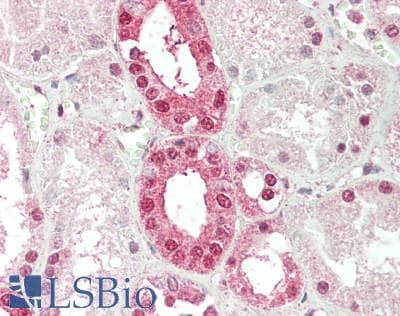 IHC-plus™ Polyclonal Rabbit anti-Human PD2 / PAF1 Antibody (aa475-525, IHC)