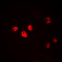 Polyclonal Rabbit anti-Human HEN1 + HEN2 Antibody (Internal, IHC, IF, WB)