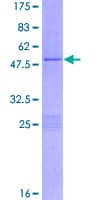 Human RGS2 Protein (Recombinant GST)