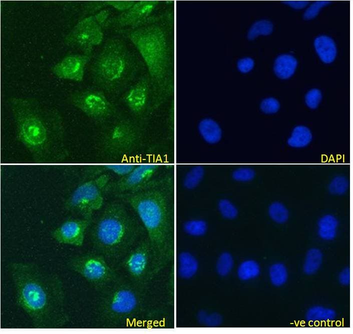 IHC-plus™ TIA-1 Antibody (aa189-199)