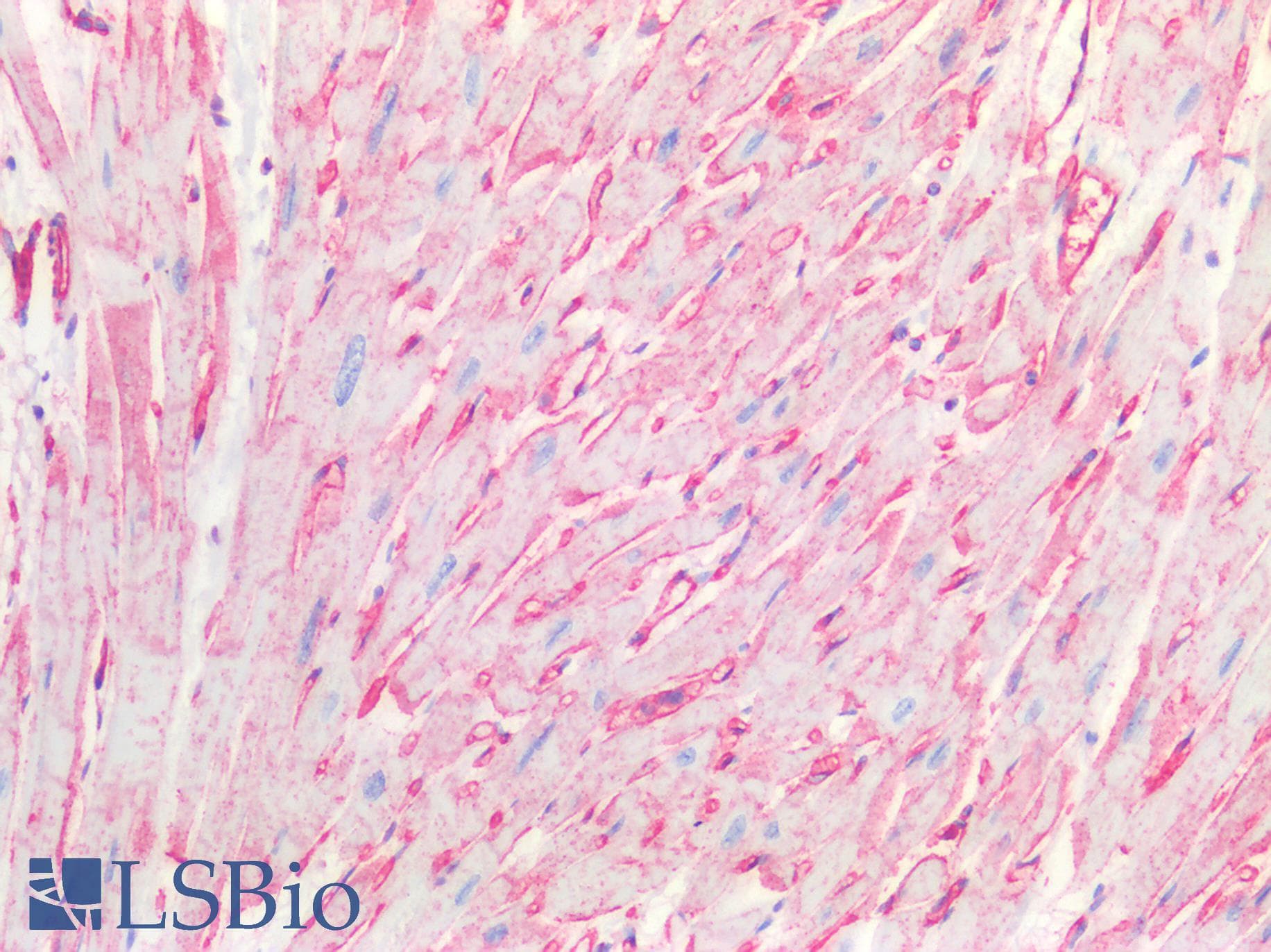 IHC-plus™ CAV1 / Caveolin 1 Antibody (N-Terminus)