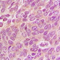 Mitofusin 2 / MFN2 Antibody (Internal)