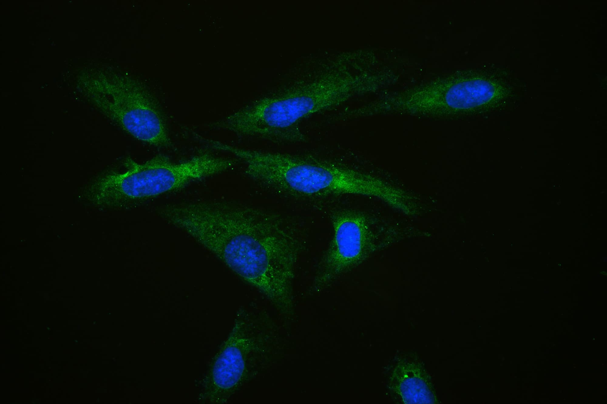 Polyclonal Rabbit anti-Human RPS27 / Ribosomal Protein S27 Antibody (IHC, WB)