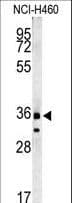 FAM49A Antibody (aa5-33)