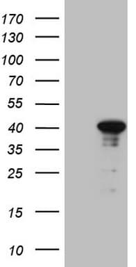 CENPQ Antibody (clone OTI1C5)