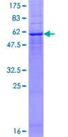 Human DEGS1 Protein (Recombinant GST)