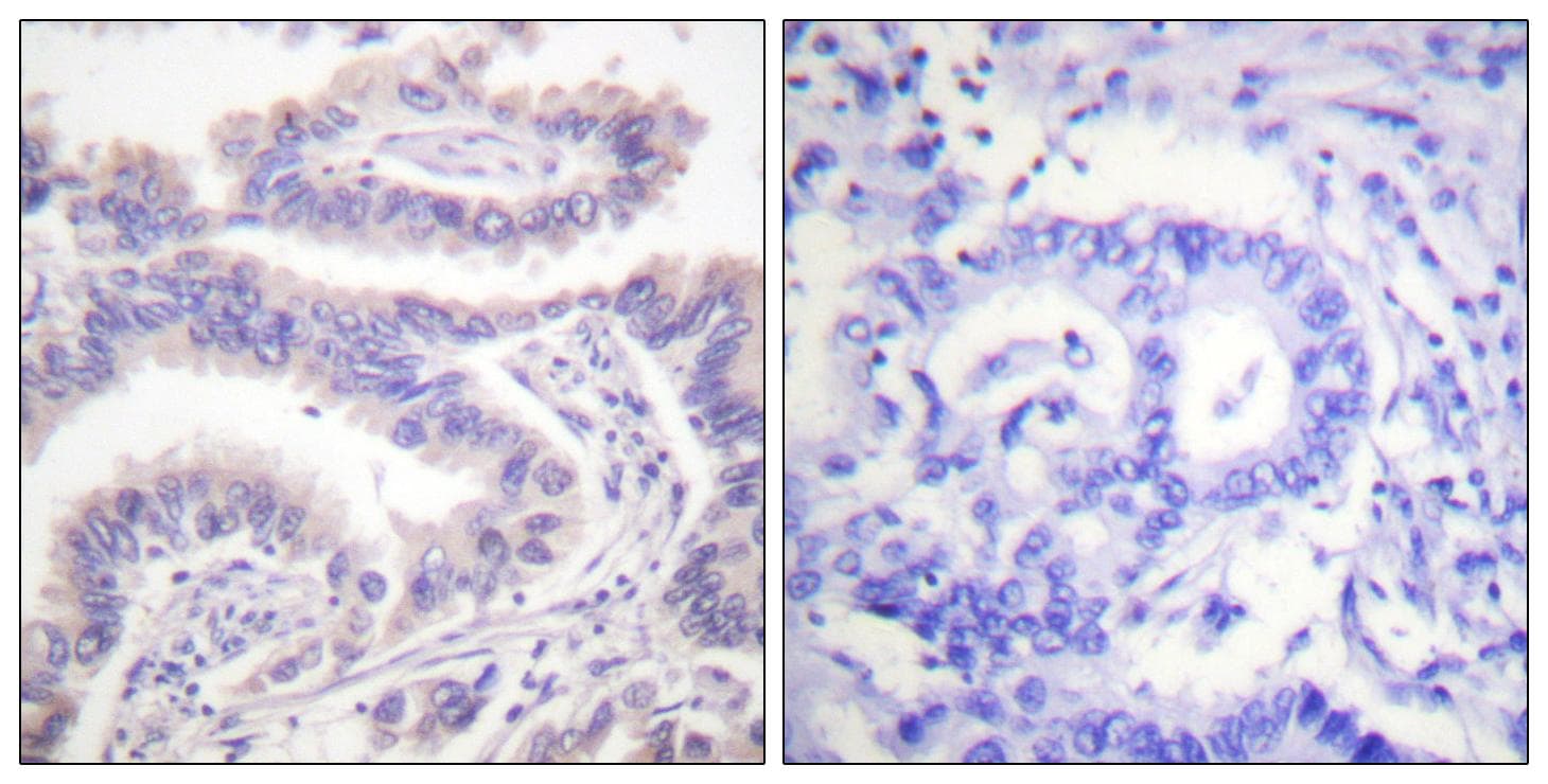 Polyclonal Rabbit anti-Human KIF11 / EG5 Antibody (phospho-Thr926, IHC, IF, WB)