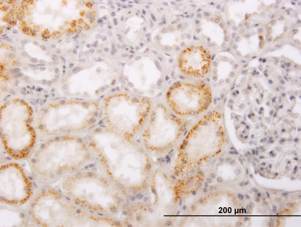 ACCS / ACS Antibody (clone 1D2)