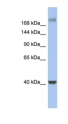 HCF1 / HCFC1 Antibody (C-Terminus)