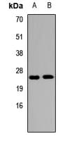 S100A3 / S100E Antibody