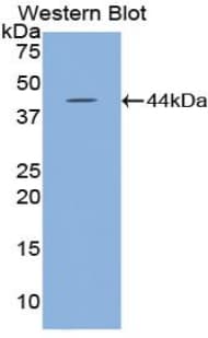 HYAL2 Antibody (aa23-447)