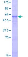 Human TNFAIP3 / A20 Protein (Recombinant GST)