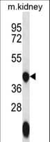 Polyclonal Rabbit anti-Human GTPBP10 Antibody (aa243-271, WB)