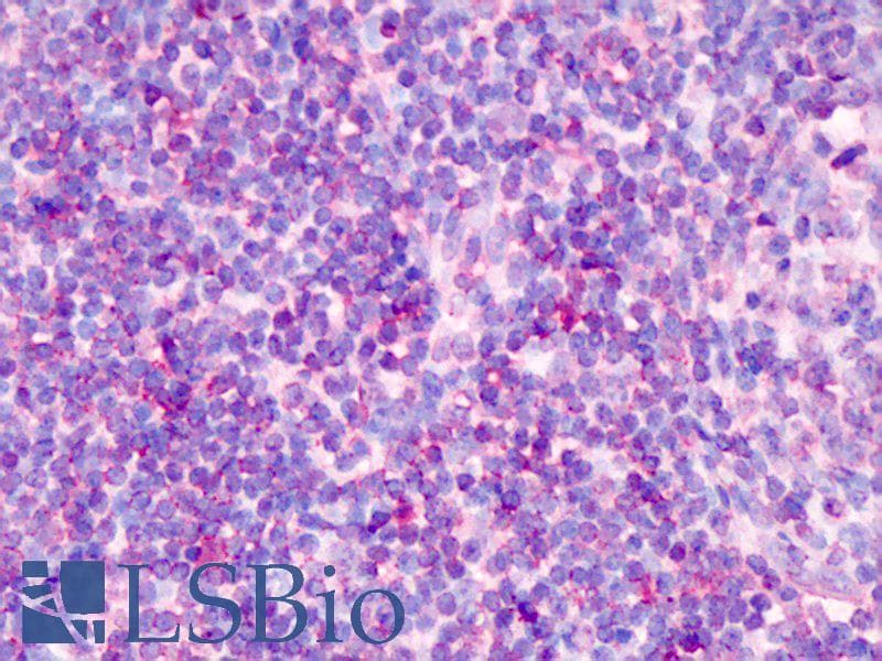 Polyclonal Rabbit anti-Human TCF7 Antibody (aa228-277, IHC, WB)