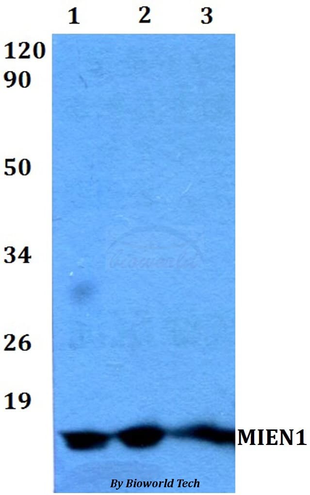 Polyclonal Rabbit anti-Human XTP4 / C17orf37 Antibody (WB)