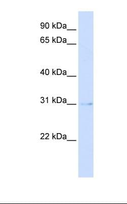 PVRIG Antibody (aa146-195, Biotin)
