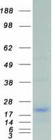 Human UBE2I / UBC9 Protein (Recombinant Myc-DDK (Flag))