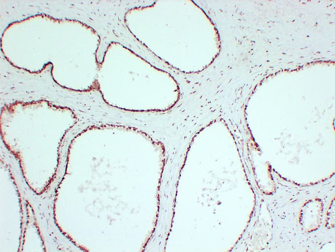 AR / Androgen Receptor Antibody (clone ABT-AR)