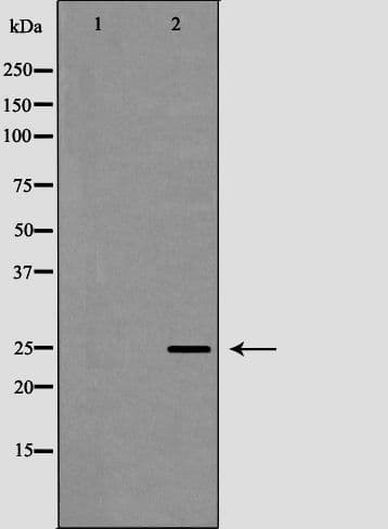 FBXO32 / Fbx32 Antibody
