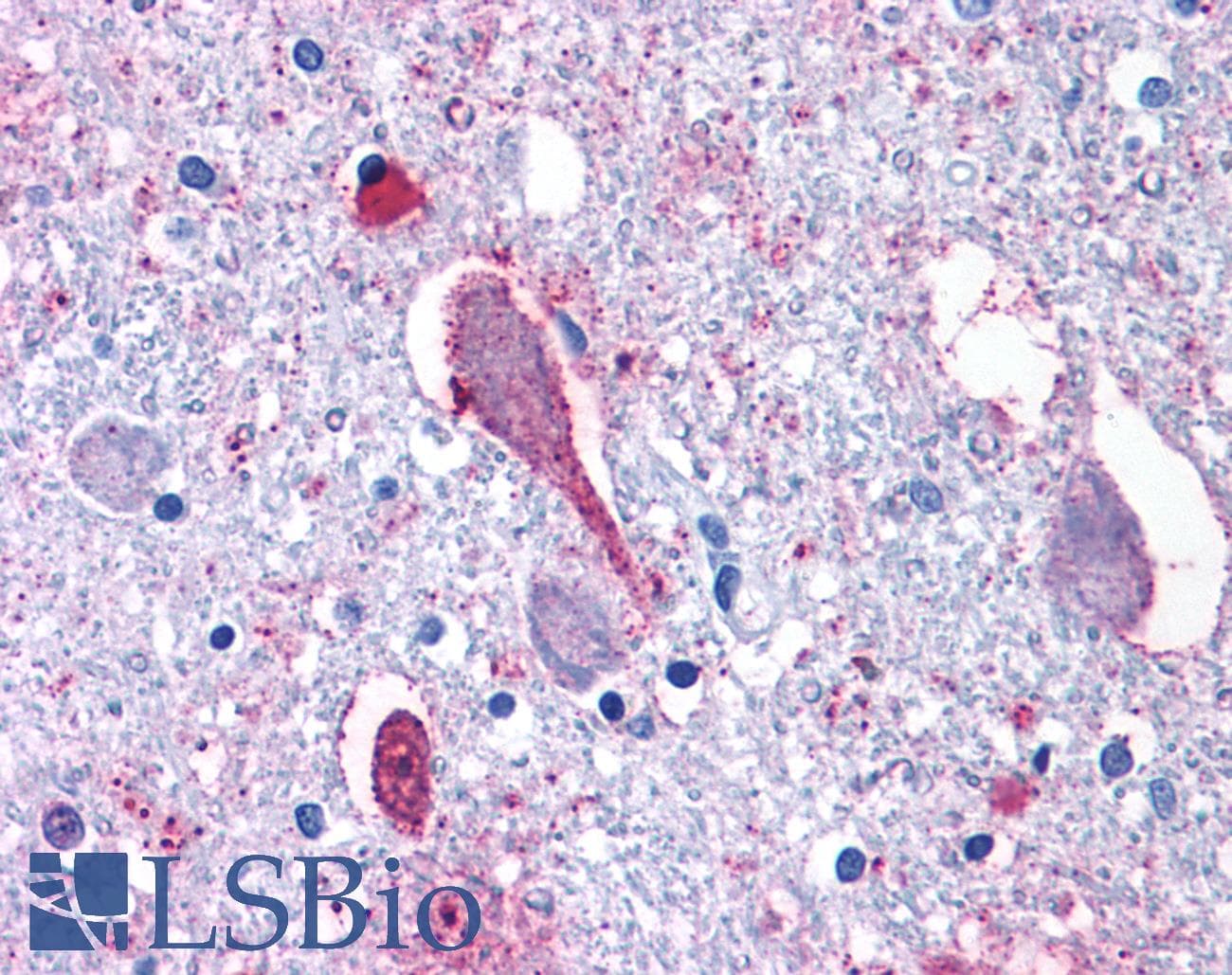 PathPlus™ Polyclonal Rabbit anti-Human CRFR1 / CRHR1 Antibody (Extracellular Domain, IHC)