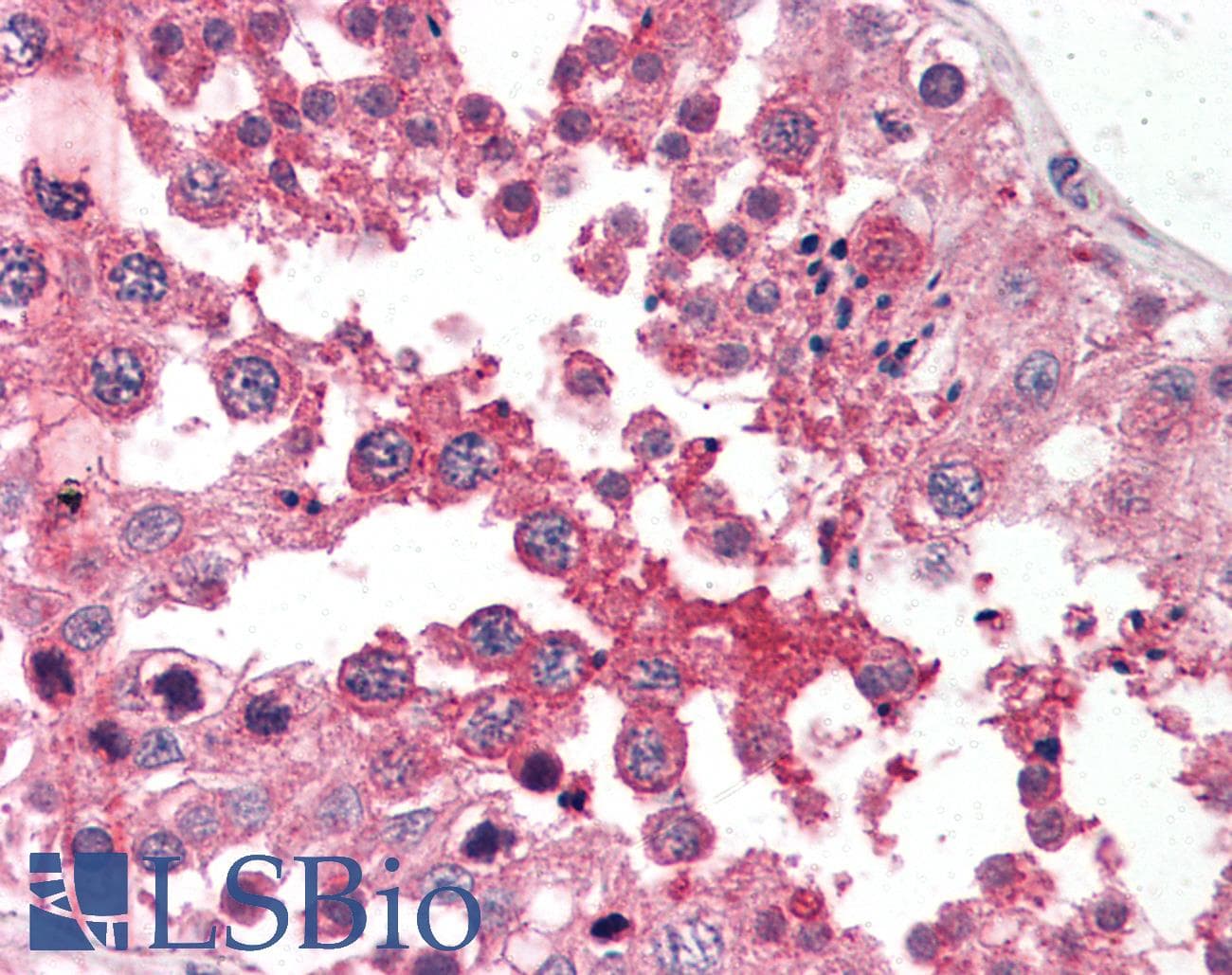 IHC-plus™ GPC4 / Glypican 4 Antibody (N-Terminus)