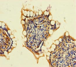 Polyclonal Rabbit anti-Human ARHGAP19 Antibody (WB)