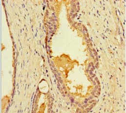 LIMS3 Antibody